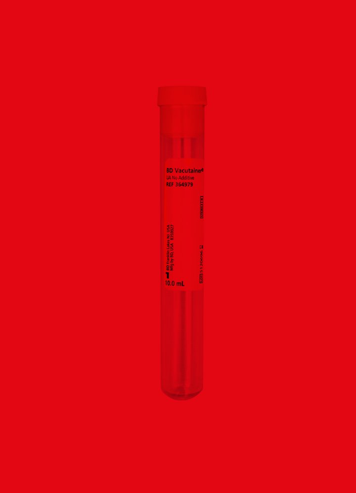Urine vacutainer