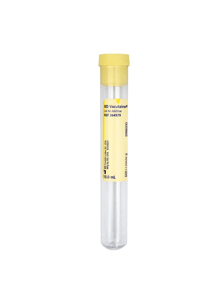 Urine vacutainer